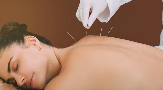 How Acupuncture Can Aid in Digestive Health and Gut Function